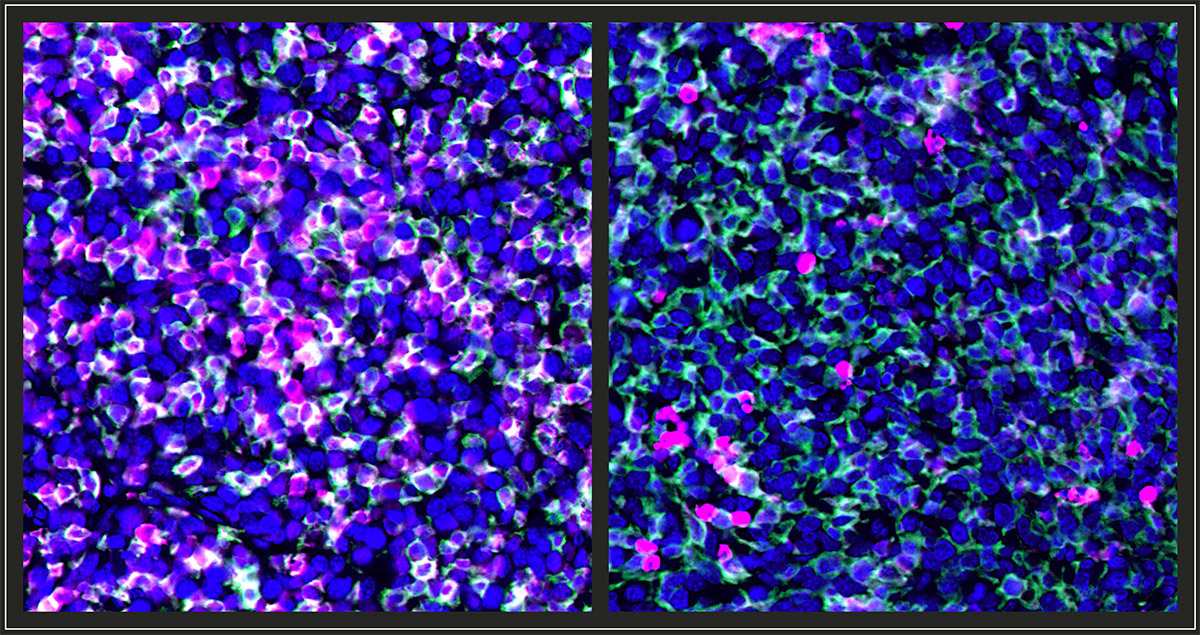 Carcinogen-exposed cancer cells transform that nature of tumor-infiltrating macrophages from immunosuppressive (left) to immune activating agents (right), rendering the cancer immunogenic.