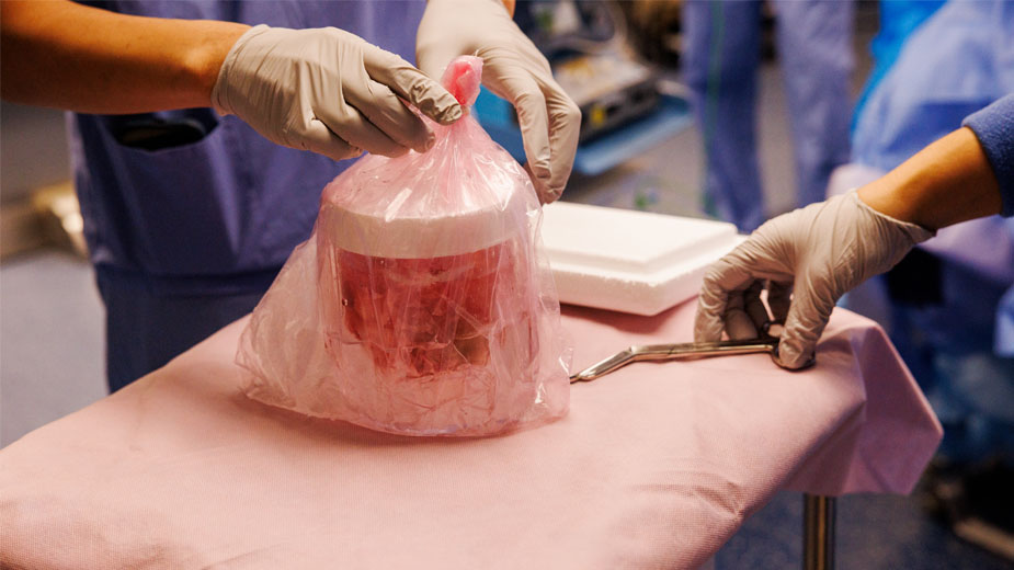A closeup of the kidney in its jar before surgery.
