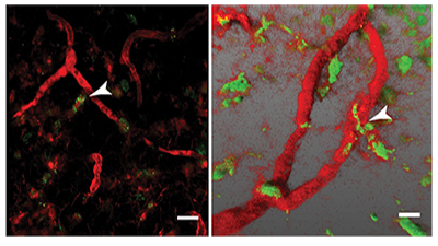 Transit of Tumor Cells Through Lymph Node Vasculature - October 2018 Advances article