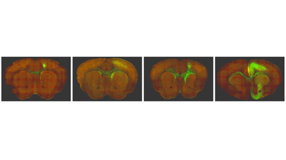 Green fluorescent protein (GFP) imaging of glioma tumor development over time in a genetically engineered mouse model of IDH-mutant glioma developed by the lab. Glioma tumor cells are GFP+. Green fluorescent protein (GFP) imaging of glioma tumor development over time in a genetically engineered mouse model of IDH-mutant glioma developed by the lab. Glioma tumor cells are GFP+.