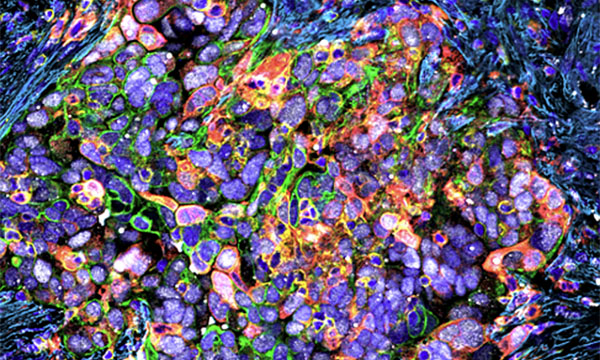 Research image from the Lowe laboratory.