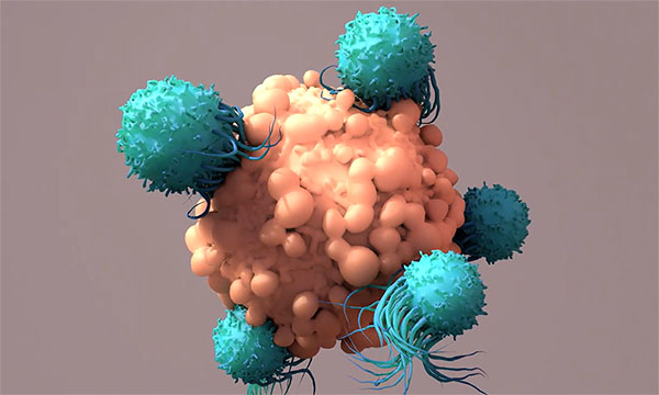 CAR T-Cell CAR T-Cell