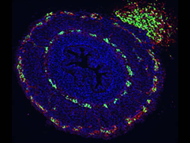 Image of a 12 day-old embryonic chick intestine labeled with a neuronal antibody (Hu, green) and a neural crest cell antibody (HNK, red)