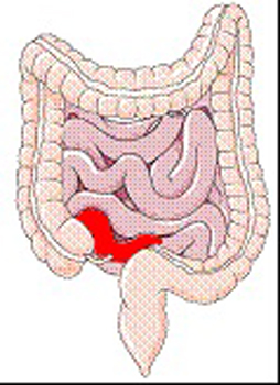 Diagram of the intestines with the end of the small intestine highlighted.