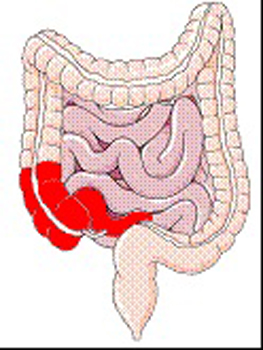 Diagram of the intestines portions of both the large intestine and the small intestine highlighted.