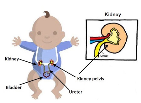 Baby with diagram of kidneys and bladder.