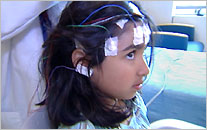 A young girl with EEG pads on her head.