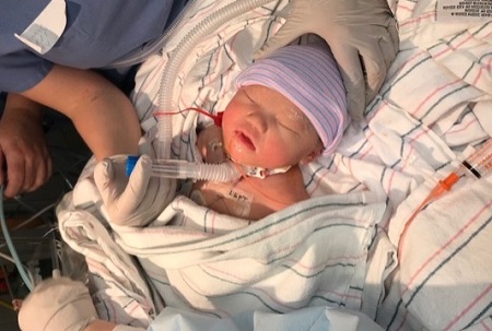 A photo of Inrid Ramos in the NICU shortly after she was born.