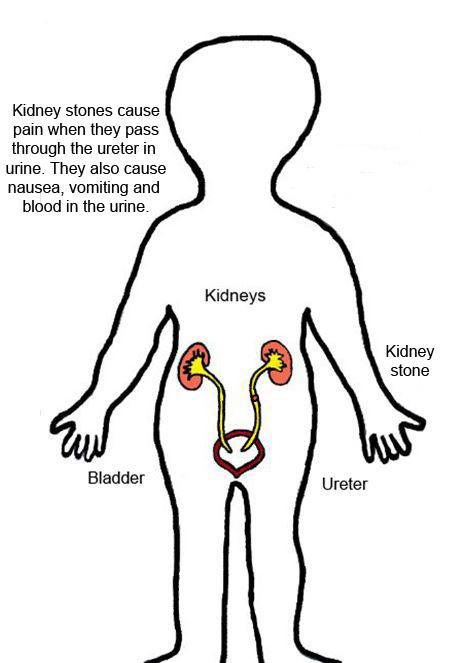 Drawing of the location of the kidneys and bladder in the body.