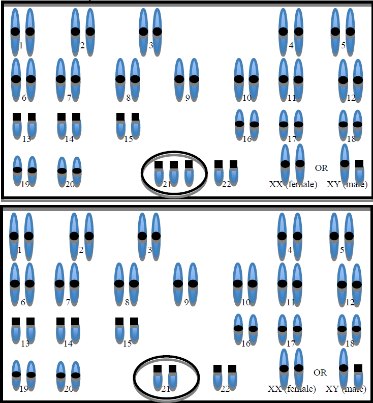 Diagram of the chromosomes of cells with and without Down Syndrome, with circles around the chromosomes that are different.