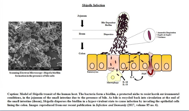 Shigella infection diagram