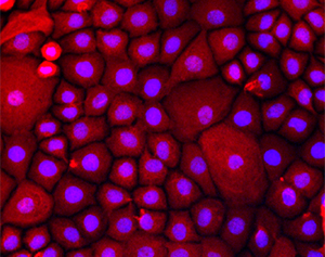lung cells
