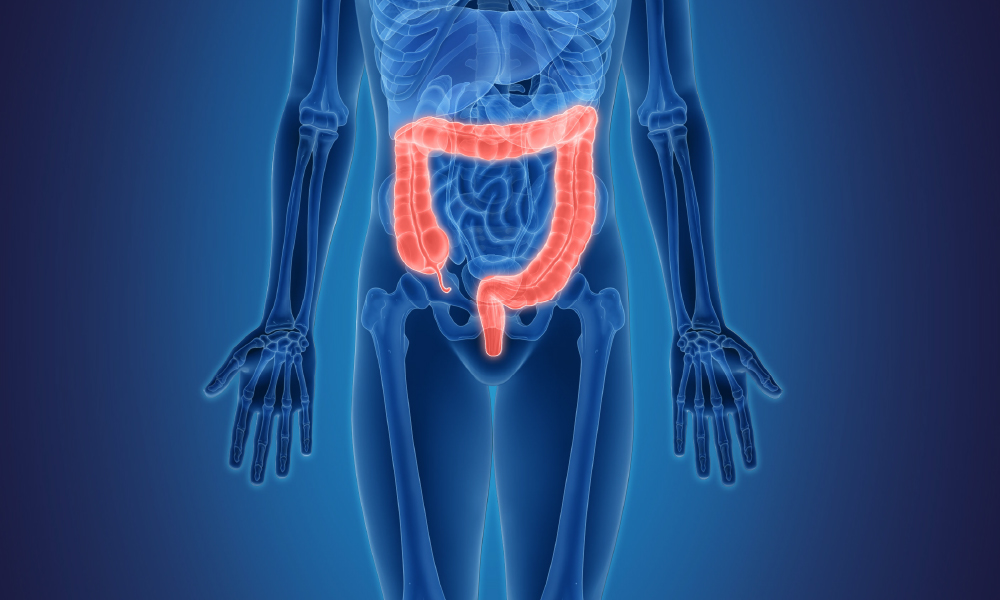 Click the video to learn about performance data for Mass General surgical procedures that treat conditions of the colon Click the video to learn about performance data for Mass General surgical procedures that treat conditions of the colon