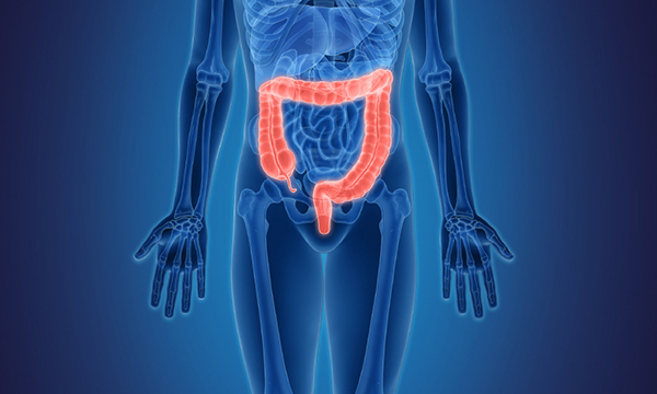 Click the video to learn about performance data for Mass General surgical procedures that treat conditions of the colon Click the video to learn about performance data for Mass General surgical procedures that treat conditions of the colon