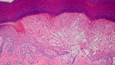 Dermatopathology services