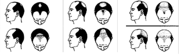 Hair Loss Clinic