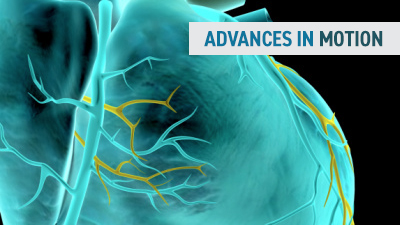 Advances in Motion Learn more about Advances in Motion