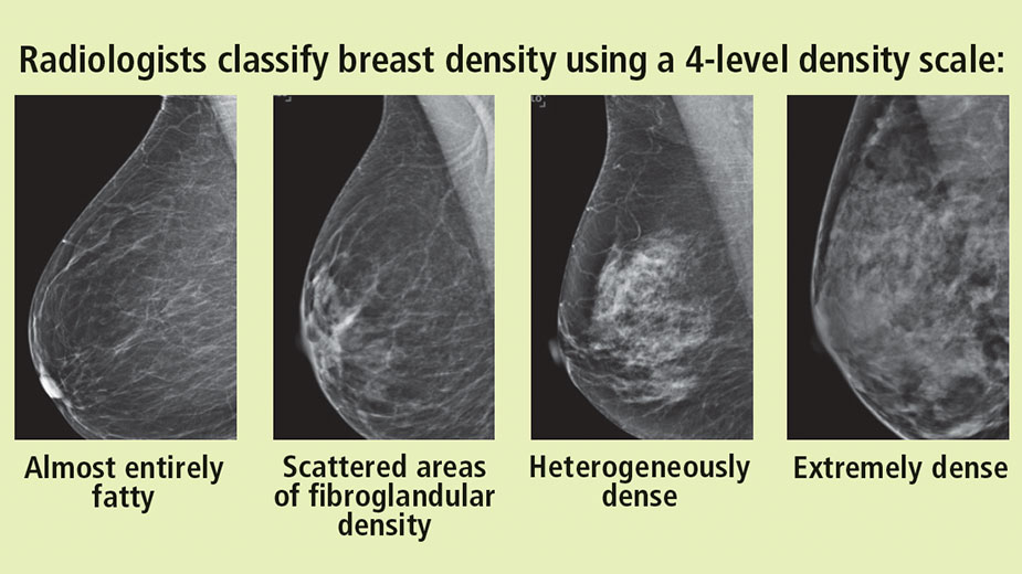 FAQ - Breast Density
