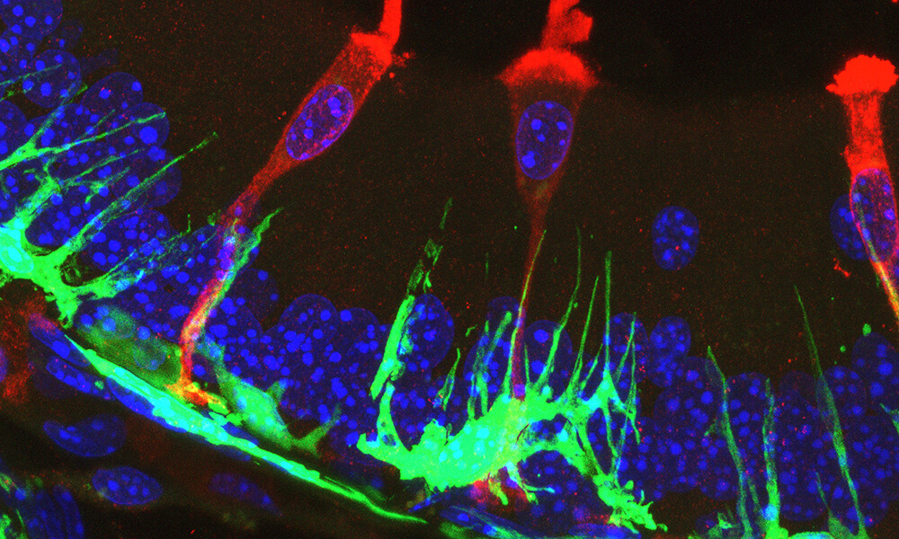 Close interaction between epithelial narrow cells and mononuclear phagocytes in the epididymis. 