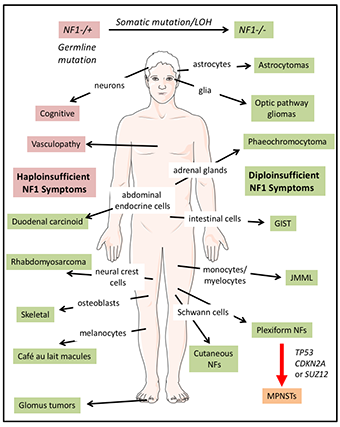 Diagram of NF1 affects