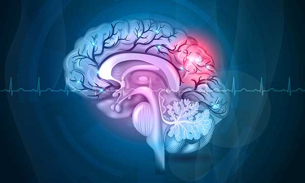 Drawing of a cross-section of a brain with different parts of the brain highlighted.
