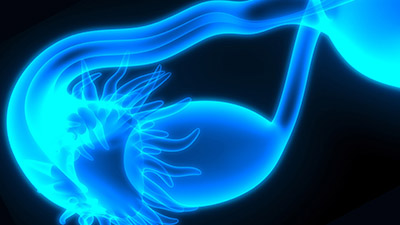 Advances in Motion OBGYN Advances in Motion