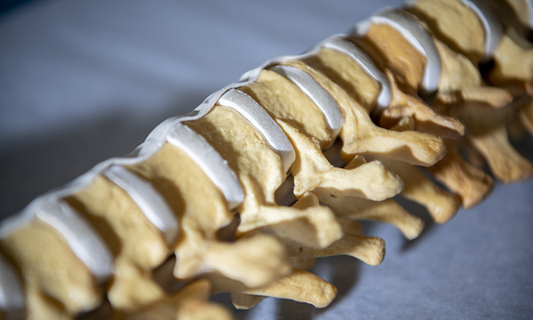 A spine model with a tethering device