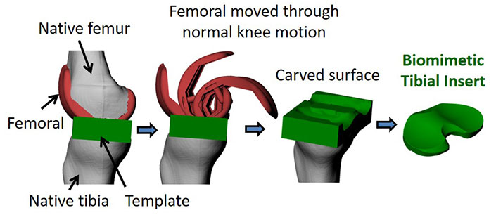 Harris Lab, Transitional Research, Advanced TKA Implant Articular Surfaces