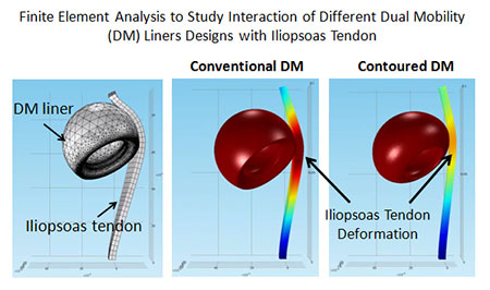 Computational Modeling and FEA of Implant Designs, Figure 1, Harris Orthopaedics Laboratory, Department of Orthopaedic Surgery, Mass General