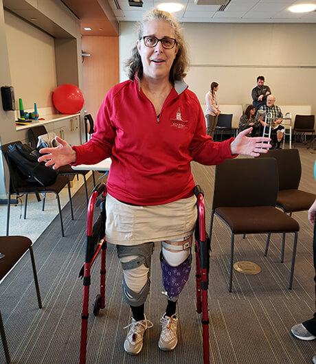 picture of female ICAN patient with a double leg amputation