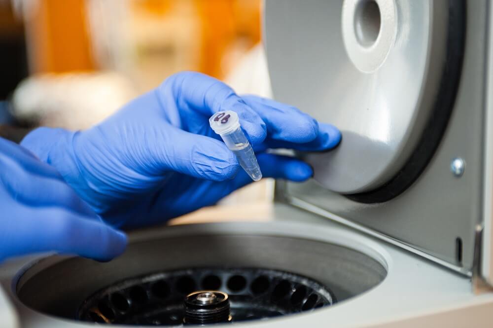 Loading samples into a centrifuge