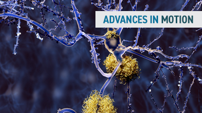 Advances in Motion Learn about Advances in Motion