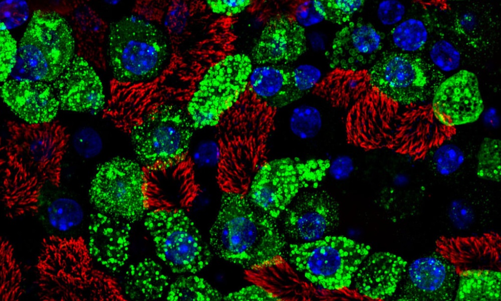 Microscope slide: Mature airway epithelium cells