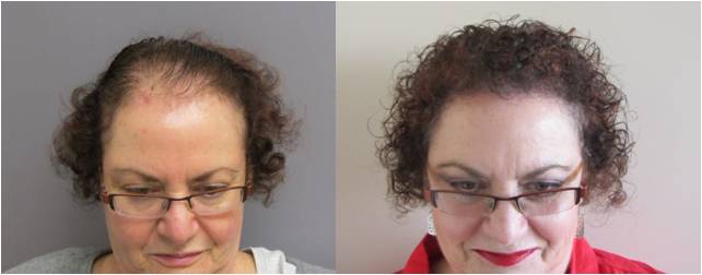 Plastic Surgery Before and After Photos Boston MA
