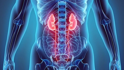 Kidney Transplant Kidney transplant program