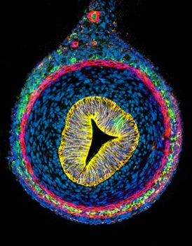 Neurointestinal Embryonic Colon