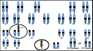 Diagram of the chromosomal pairs in balanced translocation.