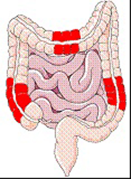 Diagram of the intestines with three sections of the large intestine highlighted.