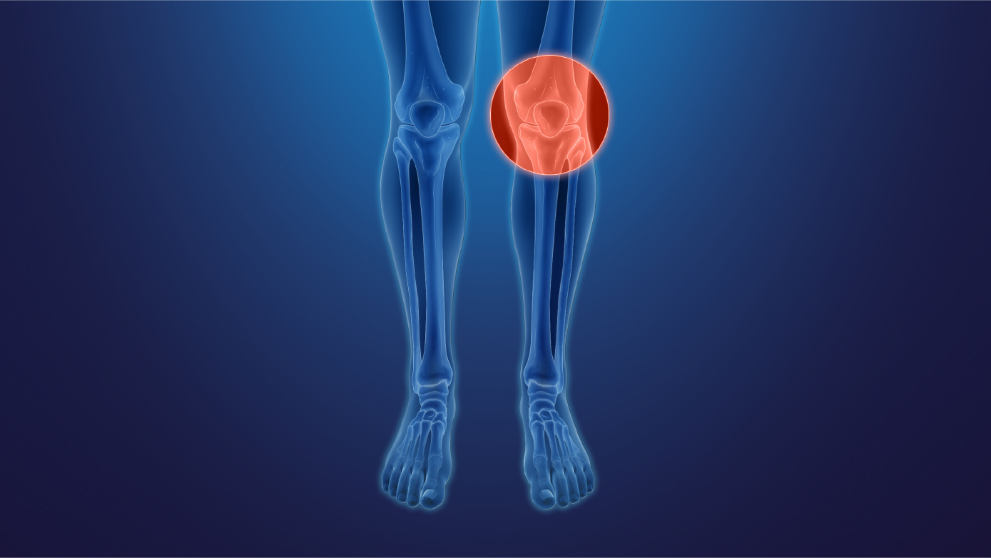 Knee