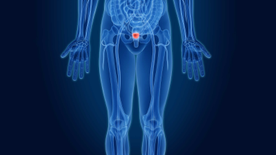 Prostate