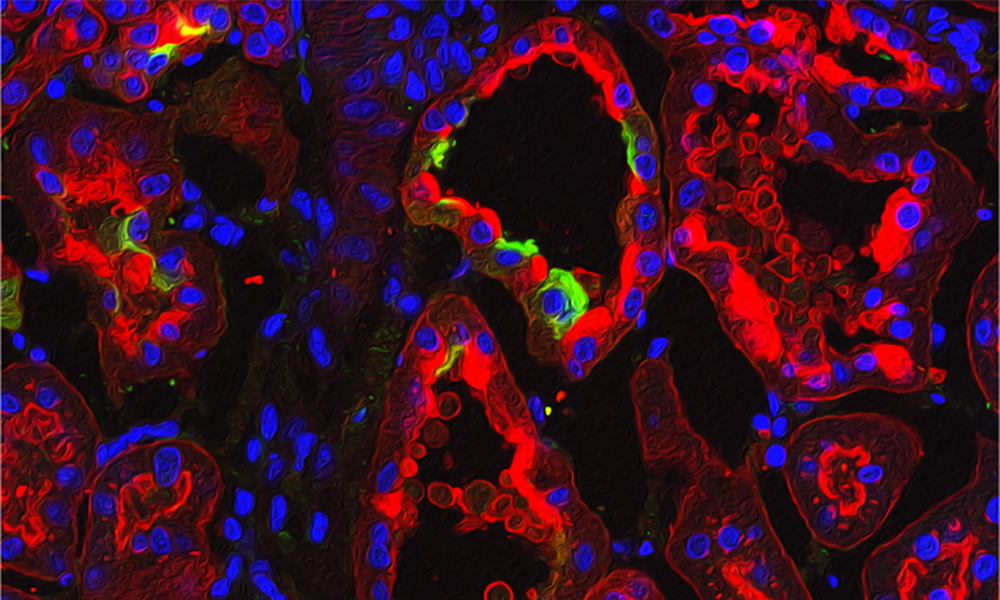 Increased VEGF‐A causes age‐dependent choroidal neovascularization Increased VEGF‐A causes age‐dependent choroidal neovascularization