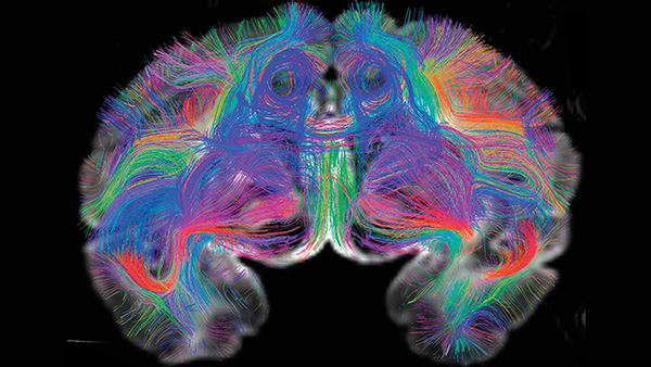 Human Connectome Project Human Connectome Project