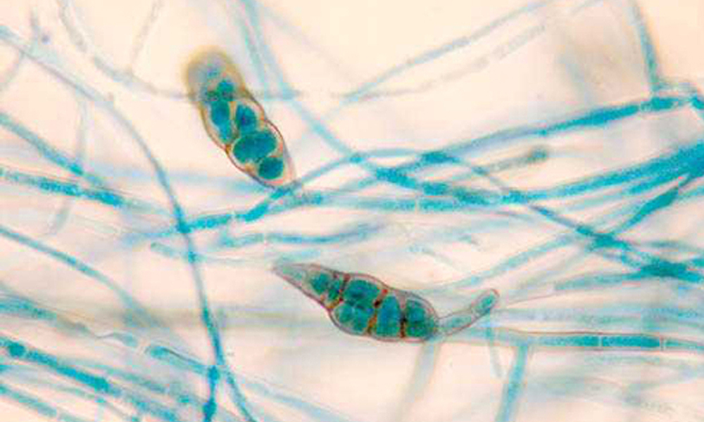 Microscope slide of Alternaria fungus cells Microscope slide of Alternaria fungus cells