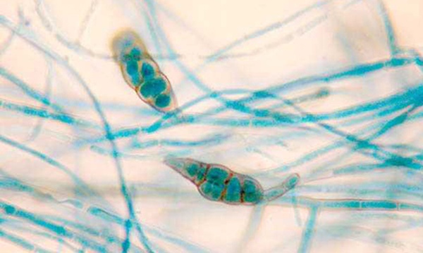 Microscope slide of Alternaria fungus cells Microscope slide of Alternaria fungus cells