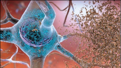 Neuroinflammation and Alzheimer’s Disease Risk