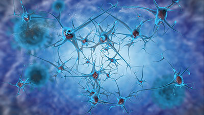 Panel Discussion on Precision Medicine Approach to Alzheimer's Disease