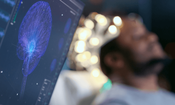 Brain imaging in a clinical setting Brain imaging in a clinical setting