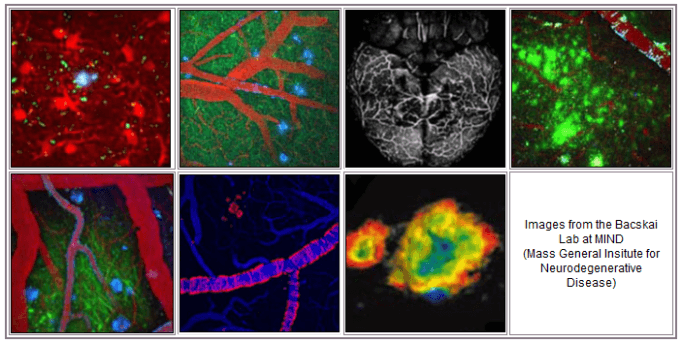 Images from the Bacskai Lab at MIND