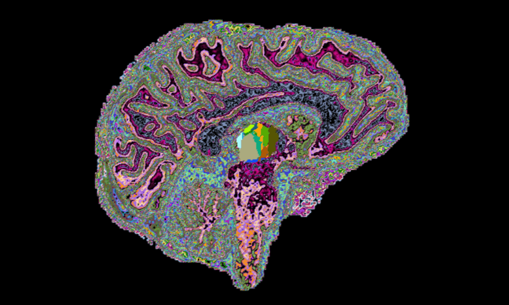 Artist's rendering of brain anatomy and activity Artist's rendering of brain anatomy and activity