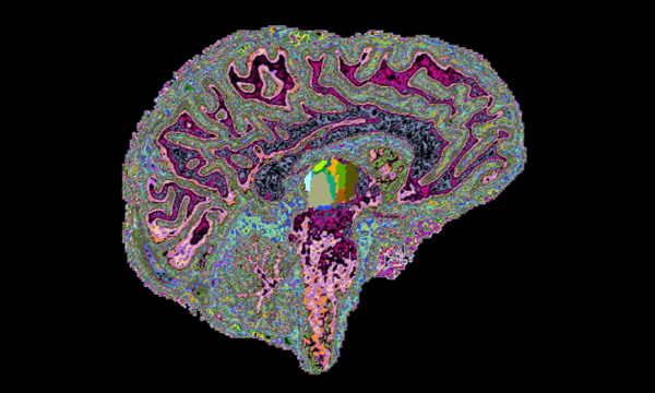 Artist's rendering of brain anatomy and activity Artist's rendering of brain anatomy and activity